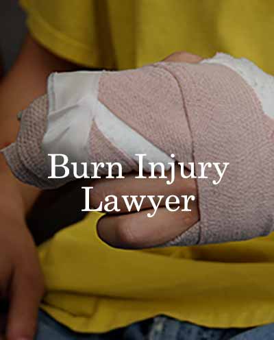 Person injured and needs a burn injury lawyer.